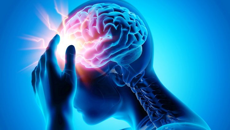 Epileptični napad - Šta je padavica i kako se leči epilepsija