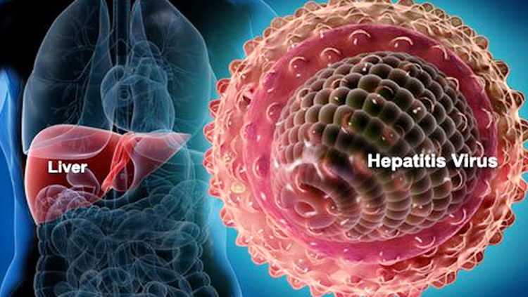Analiza šta je hepatitis i koje vrste hepatitisa imamo