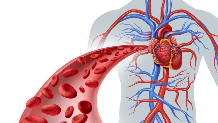 Cirkulacija krvi Šta je ateroskleroza, simptomi, nastanak i lečenje ateroskleroze