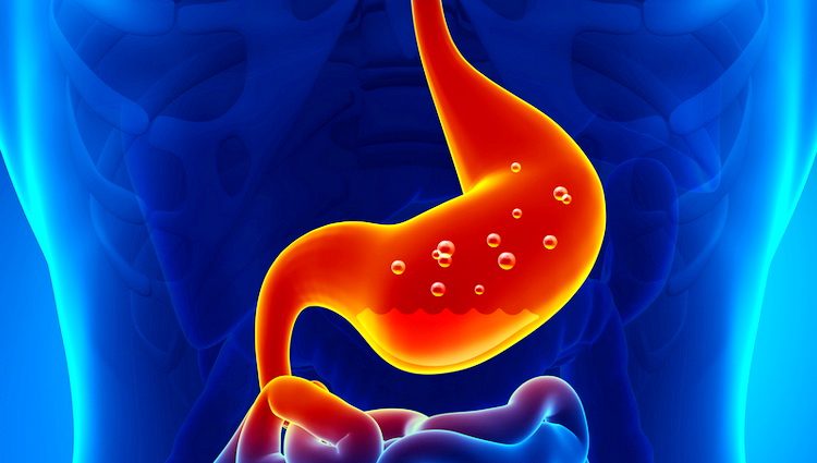 Šta je GERB (Žgaravica) -  Gastroezofagealna refluksna bolest