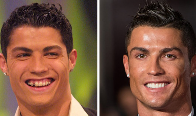 Kristijano Ronaldo nekada i sad Slavne ličnosti