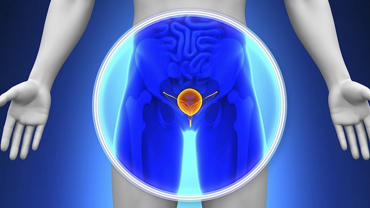 Rak prostate dijagnoza i simptomi lečenje raka prostate