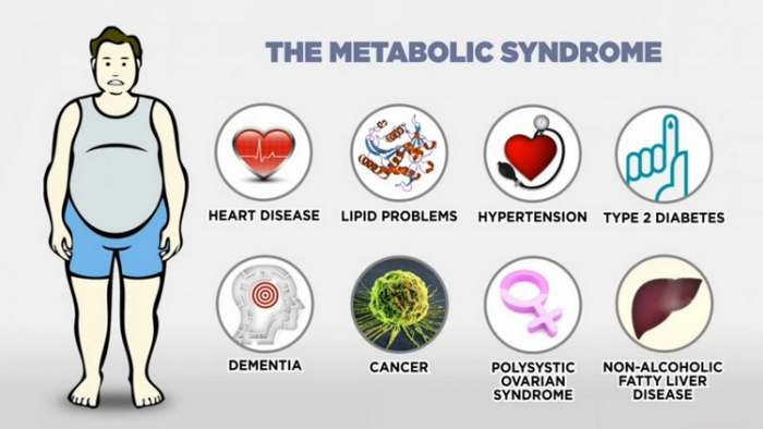 Kako se leči insulinska rezistencija i metabolički sindrom