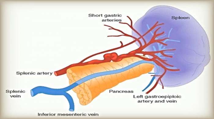 aneurizma slezinske arterije